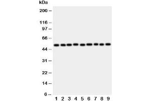 Image no. 1 for anti-E2F Transcription Factor 2 (E2F2) (C-Term) antibody (ABIN3030789)