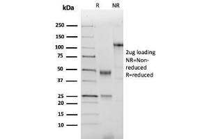 Image no. 1 for anti-NK2 Homeobox 2 (Nkx2-2) (AA 1-119) antibody (ABIN6940206)