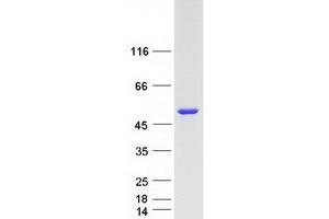 Image no. 1 for Death-Associated Protein Kinase 3 (DAPK3) protein (Myc-DYKDDDDK Tag) (ABIN2719223)