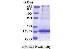 Image no. 1 for NADH Dehydrogenase (Ubiquinone) Flavoprotein 3, 10kDa (NDUFV3) (AA 35-108) protein (His tag) (ABIN5853263)