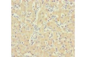 Immunohistochemistry of paraffin-embedded human liver tissue using ABIN7156211 at dilution of 1:100