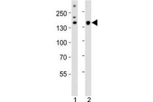 Western blot analysis of lysate from 1) HeLa cell line and 2) mouse cerebellum tissue using Kdm6b antibody at 1:1000.