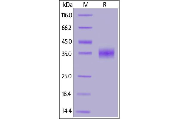 SARS-CoV Spike Protein (RBD) (His tag)