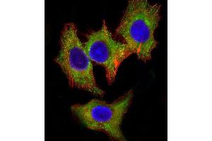 Image no. 3 for anti-Hemopoietic Cell Kinase (HCK) antibody (ABIN4910490)