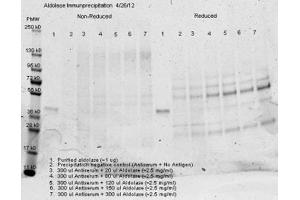 Image no. 2 for anti-Aldolase (ALD) antibody (ABIN94901)