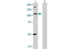 Image no. 1 for anti-Liprin-beta-2 (PPFIBP2) (AA 1-876) antibody (ABIN521943)