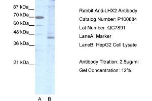 Image no. 1 for anti-LIM Homeobox 2 (LHX2) (Middle Region) antibody (ABIN2792632)