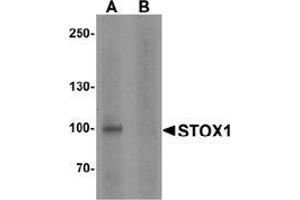 anti-Storkhead Box 1 (STOX1) (C-Term) antibody