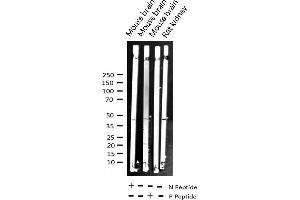 Image no. 1 for anti-NF-kappa-B inhibitor beta (NFKBIB) (pSer23) antibody (ABIN6256201)