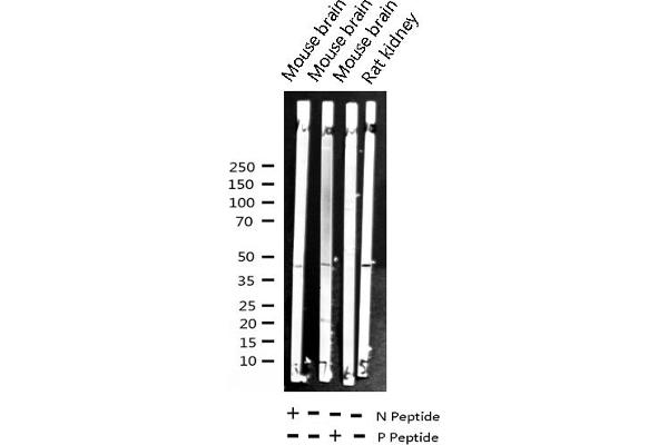 NFKBIB 抗体  (pSer23)