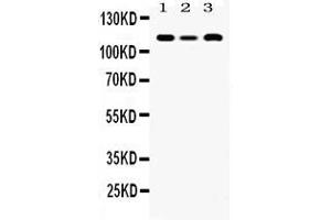 Image no. 1 for anti-Helicase-Like Transcription Factor (HLTF) (AA 911-1009) antibody (ABIN4886619)