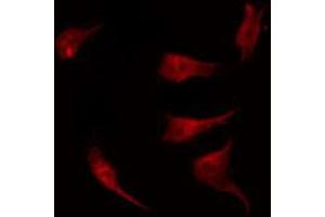 Image no. 1 for anti-General Transcription Factor II I Repeat Domain-Containing 1 (GTF2IRD1) antibody (ABIN6266016)