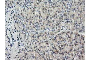 Image no. 4 for anti-HRas proto-oncogene, GTPase (HRAS) antibody (ABIN1498713)