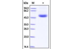 Influenza A [A/Thailand/1(KAN-1)/2004 (H5N1)] NA on SDS-PAGE under reducing (R) condition.