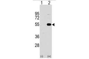 Image no. 2 for anti-Sprouty-Related, EVH1 Domain Containing 1 (SPRED1) (N-Term) antibody (ABIN356947)
