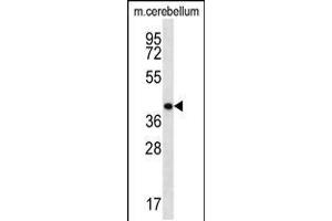 Image no. 1 for anti-Homeobox D13 (HOXD13) (AA 197-226) antibody (ABIN5536746)