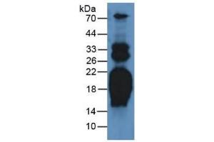 Image no. 4 for Pro-Atrial Natriuretic Peptide (PRO-ANP) ELISA Kit (ABIN6730984)