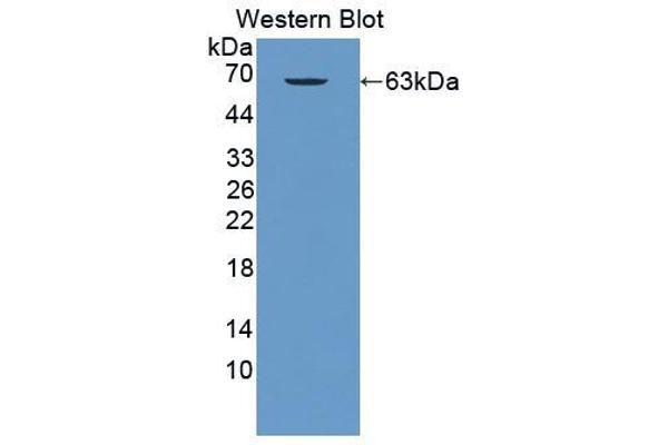 anti-Solute Carrier Family 25 (Carnitine/acylcarnitine Translocase), Member 20 (SLC25A20) (AA 1-301) antibody