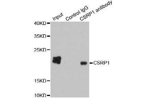 Image no. 4 for anti-Cysteine and Glycine-Rich Protein 1 (CSRP1) antibody (ABIN3021360)