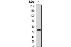 Image no. 1 for anti-Anthrax Toxin Receptor 2 (ANTXR2) (full length) antibody (ABIN6043172)