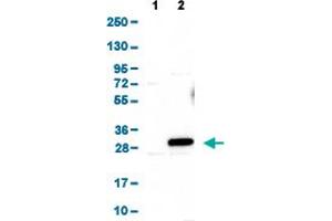 Western Blot analysis of (1) Negative control (vector only transfected HEK293T lysate), and (2) Over-expression lysate (Co-expressed with a C-terminal myc-DDK tag (~3.