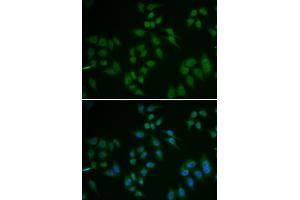 Image no. 3 for anti-Tumor Protein P63 (TP63) antibody (ABIN3023012)