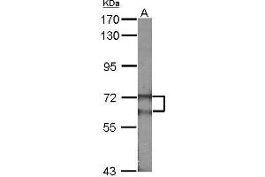 Image no. 1 for anti-Fanconi Anemia Complementation Group G (FANCG) (Center) antibody (ABIN2857083)