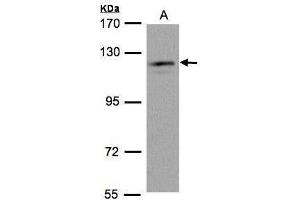Image no. 2 for anti-Ubiquitin Specific Peptidase 11 (USP11) (N-Term) antibody (ABIN2855045)