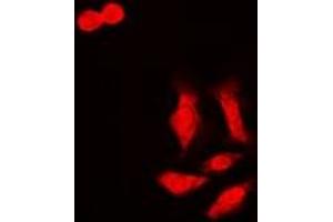 Image no. 1 for anti-LETM1 Domain Containing 1 (LETMD1) antibody (ABIN2966706)