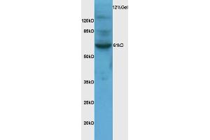 Image no. 1 for anti-Sorting Nexin 1 (SNX1) (AA 401-522) antibody (ABIN682078)