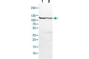 Image no. 1 for anti-Ubiquitin Specific Peptidase 4 (USP4) antibody (ABIN5590631)