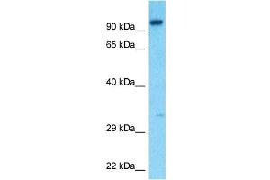 Image no. 7 for anti-Hepatocyte Growth Factor (Hepapoietin A, Scatter Factor) (HGF) (N-Term) antibody (ABIN2781816)