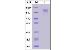 Image no. 1 for CD34 (CD34) (AA 32-290) protein (His tag) (ABIN7013676)