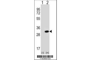 Image no. 1 for anti-Carbonic Anhydrase II (CA2) (AA 54-83), (N-Term) antibody (ABIN652314)
