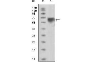 Image no. 1 for anti-TYRO3 Protein Tyrosine Kinase (TYRO3) antibody (ABIN969449)