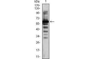 Image no. 2 for anti-K(lysine) Acetyltransferase 5 (KAT5) (AA 18-208) antibody (ABIN5542562)