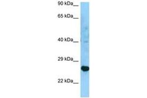 Image no. 1 for anti-Major Histocompatibility Complex, Class II, DR beta 3 (HLA-DRB3) (AA 150-199) antibody (ABIN6748304)