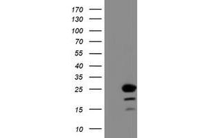 Image no. 15 for anti-Chromosome 1 Open Reading Frame 50 (C1ORF50) antibody (ABIN1497033)