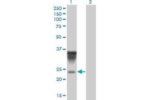 Image no. 5 for anti-Orosomucoid 1 (ORM1) (AA 18-201) antibody (ABIN562078)