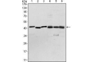 Image no. 4 for anti-3-phosphoinositide Dependent Protein Kinase-1 (PDPK1) antibody (ABIN969347)