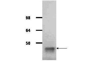 Image no. 1 for anti-Aldolase (ALD) antibody (HRP) (ABIN5596685)