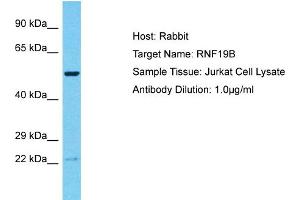 RNF19B Antikörper  (C-Term)