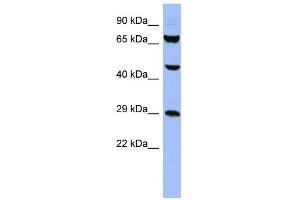 Image no. 1 for anti-Small Nuclear Ribonucleoprotein Polypeptides B and B1 (SNRPB) (N-Term) antibody (ABIN2778833)