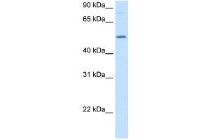 Image no. 3 for anti-Betaine--Homocysteine S-Methyltransferase (BHMT) (N-Term) antibody (ABIN629793)