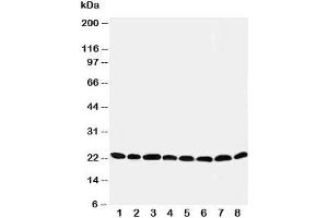 Image no. 4 for anti-Peroxiredoxin 5 (PRDX5) (C-Term) antibody (ABIN3032191)