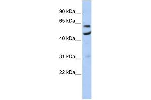 Image no. 1 for anti-CCR4-NOT Transcription Complex, Subunit 6 (CNOT6) (N-Term) antibody (ABIN2779084)