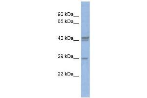 Image no. 1 for anti-CCAAT/enhancer Binding Protein (C/EBP), delta (CEBPD) (Middle Region) antibody (ABIN927722)