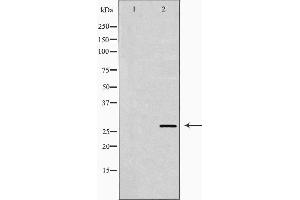 CD151 Antikörper  (N-Term)