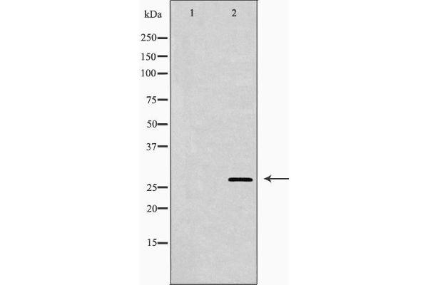 CD151 Antikörper  (N-Term)