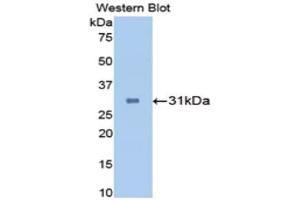Image no. 1 for anti-Carbonic Anhydrase II (CA2) (AA 1-260) antibody (ABIN1173596)